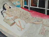 amputated teenage war victim