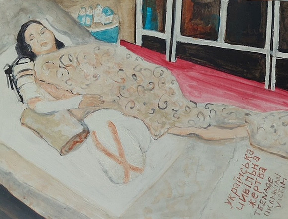 amputated teenage war victim